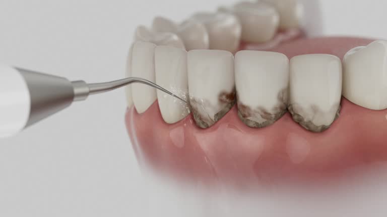 Trusted Teeth Cleaning And Checkup service in Apple Valley, CA - Dentist Open Now